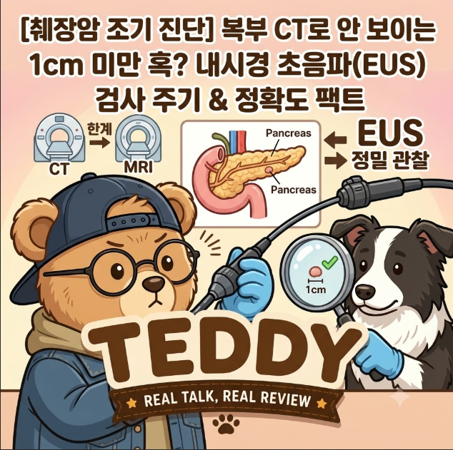 [췌장암 조기 진단] 복부 CT로 안 보이는 1cm 미만 혹? 내시경 초음파(EUS) 검사 주기 & 정확도 팩....