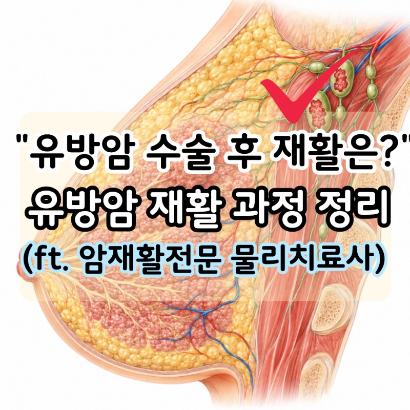 "유방암 수술 후 재활?" 림프 부종 없이 유방암 수술 후 회복하려면?