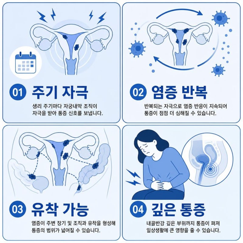 자궁내막증 치료 미레나와 수술, 어떤 상황에 고려할까?