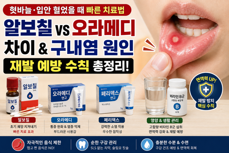 혓바늘·입안 헐었을 때 빠른 치료법 | 알보칠 vs 오라메디 차이 & 구내염 원인 및 재발 예방 ....