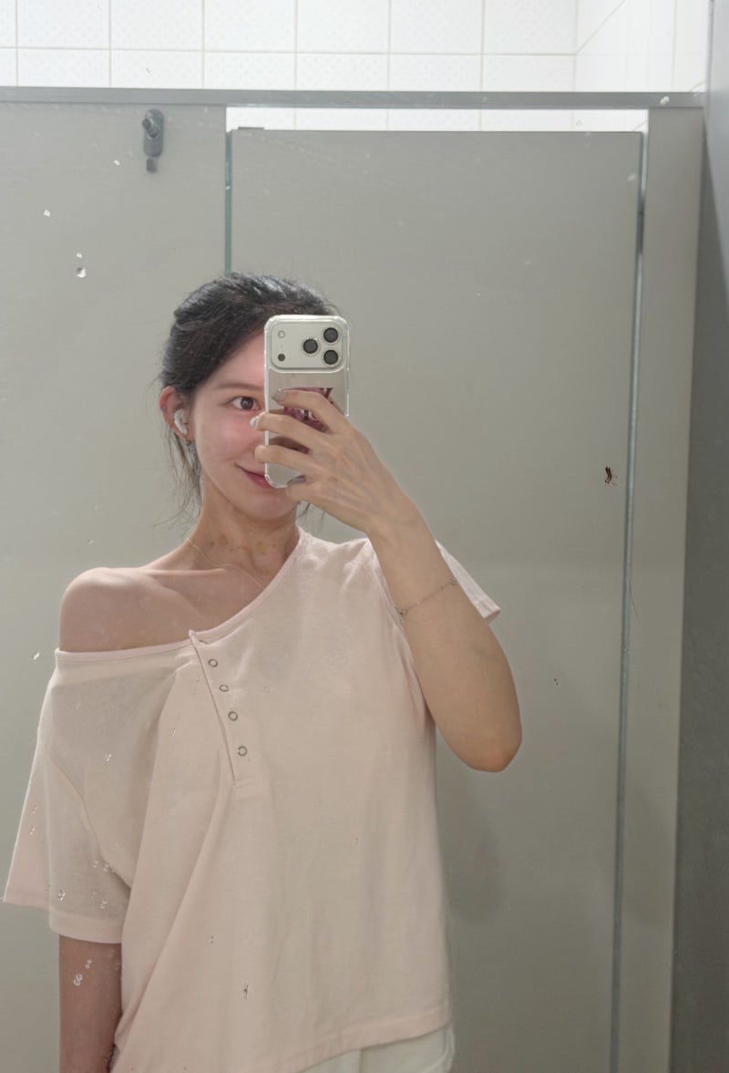 여의도피부과 승모근 보톡스 효과 후기, 메디톡신 유럽산 보톡스 60유닛 맞아본 후기 공유해....