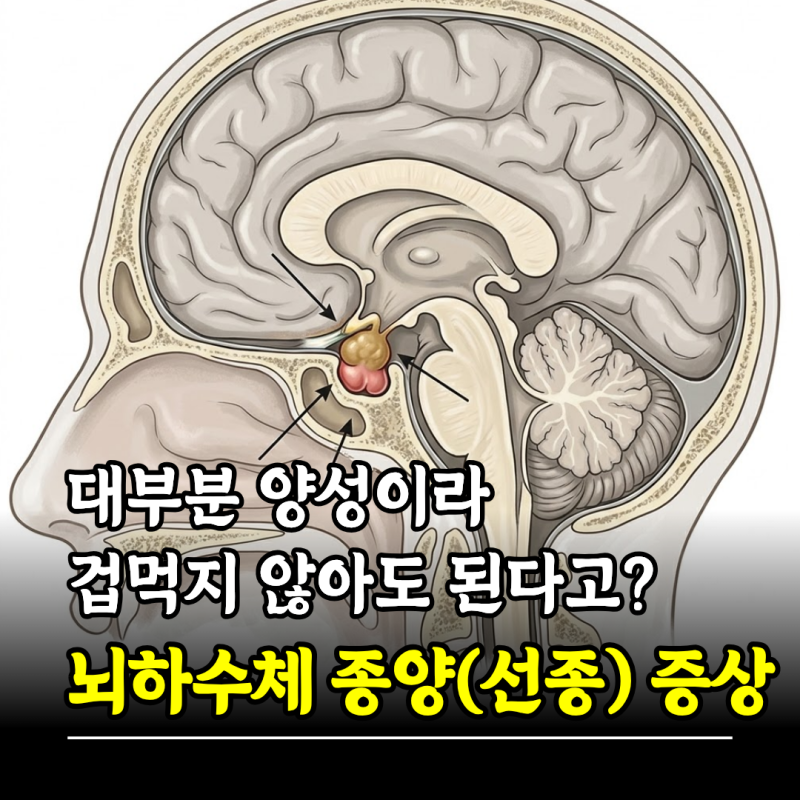 대부분 양성이라 겁먹지 않아도 된다고? 뇌하수체 종양(선종) 증상