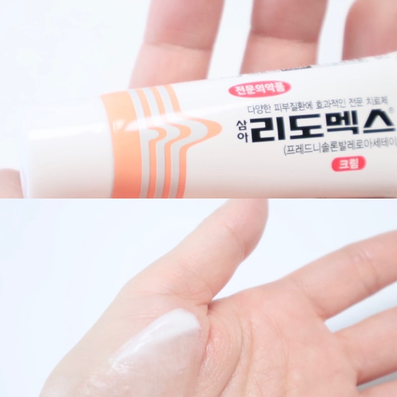 리도멕스 크림 0.3% 효능 스테로이드일까? 얼굴 피부염 습진 벌레물림 사용 전 알아둘 점
