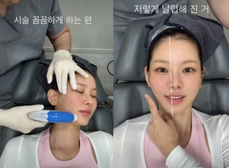 "평생 얼굴 해줄게" 맹승지, '♥병원장 남친'에게 직접 시술받은 리얼 VLOG 대공개