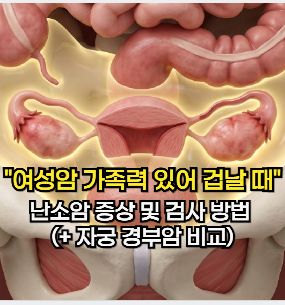 난소암 증상 "여성암 가족력이 있어 겁이 날 때" 난소암 검사 방법 및 자궁 경부암 증상 비교