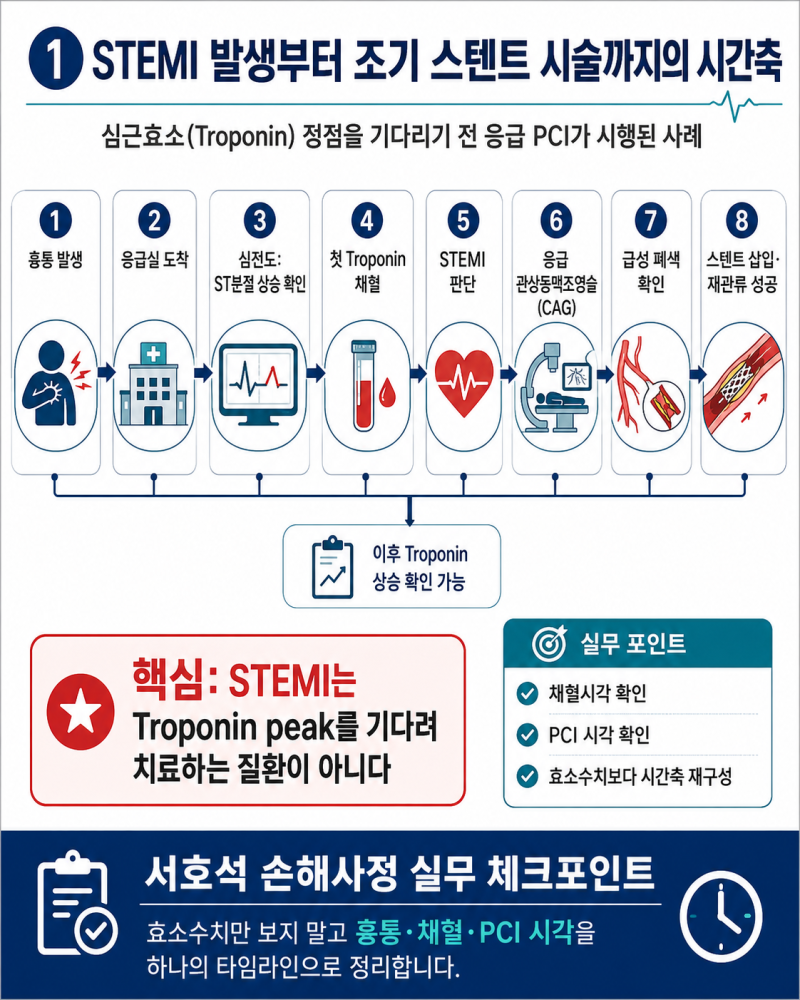 심근효소(Troponin) 오르기 전 스텐트 시술했다면 심근경색 진단비 받을 수 있을까?