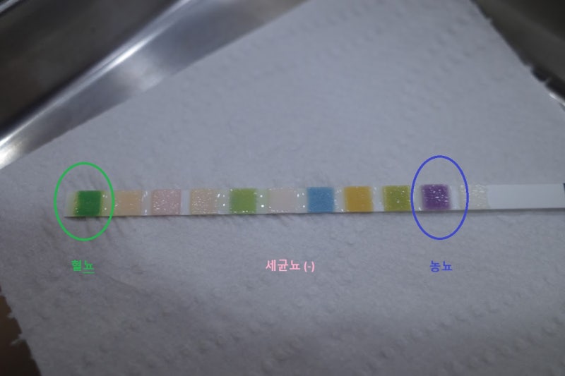 감기로 접수했으나 아닐때!의 구별, 과거 신우신염 경험에서 이해는 금방, 방광염 증상이 없....