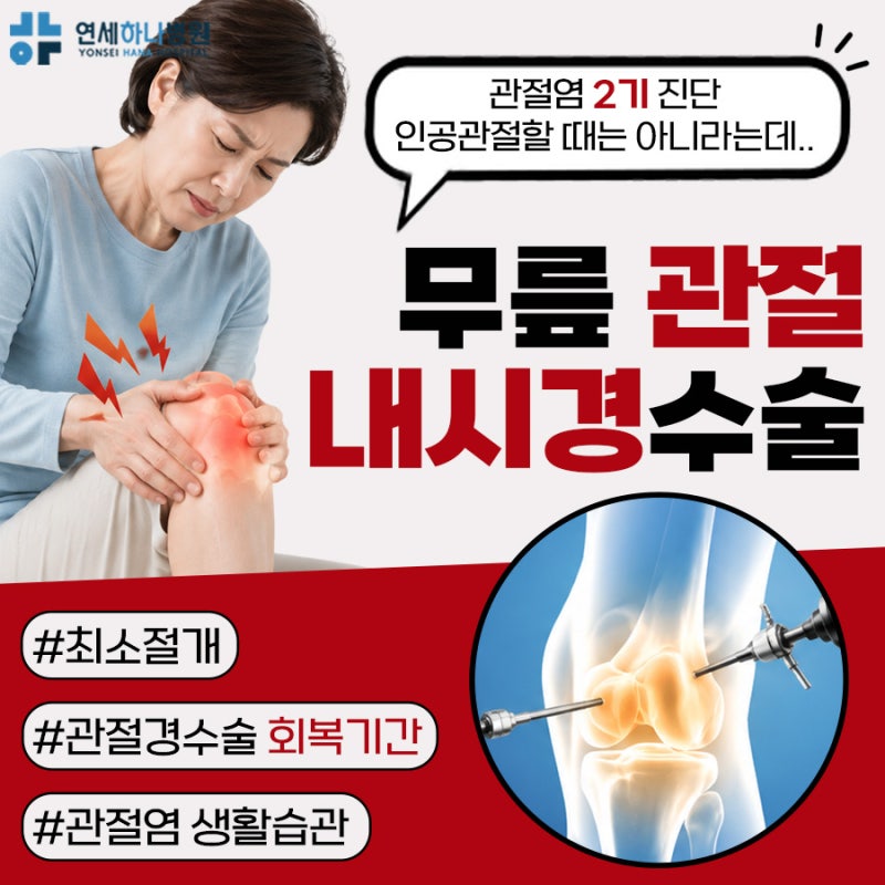 무릎관절경 수술 필요한 경우, 무릎관절염2기 진단 받았는데 해야 할까요?