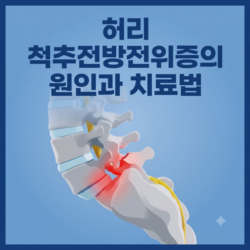 허리 척추전방전위증의 원인과 치료법 3가지