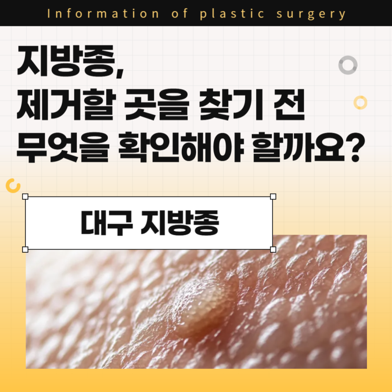 대구 지방종 병원, 제거할 곳을 찾기 전 무엇을 확인해야 할까요?