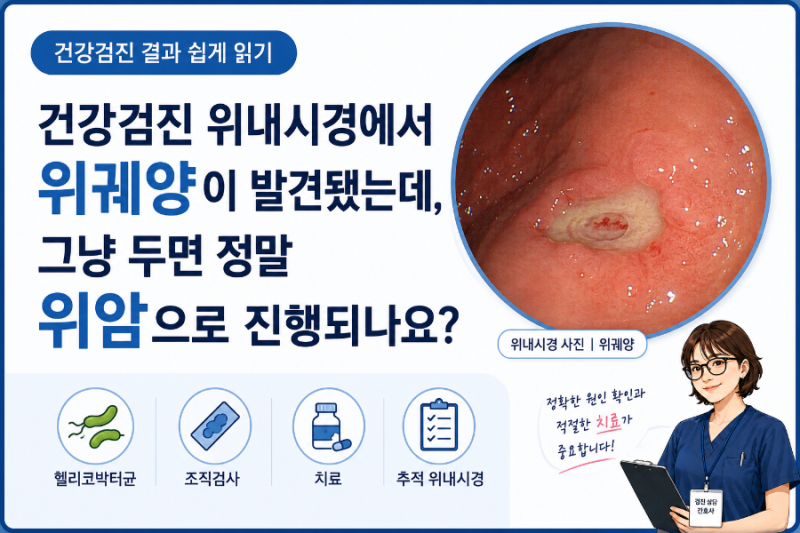 건강검진 위내시경에서 위궤양이 발견됐는데, 그냥 두면 정말 위암으로 진행되나요?건강검....