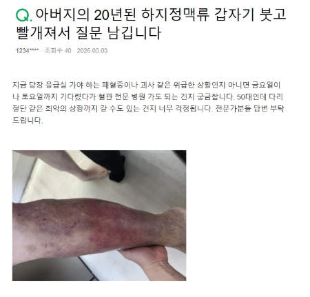 하지정맥 시술 후유증, 없으려면 알아야 할 3가지