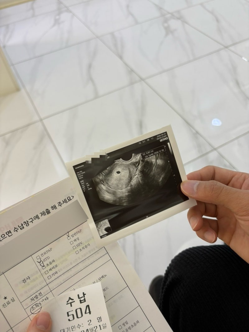 임신 극초기 증상, 4주부터 13주까지