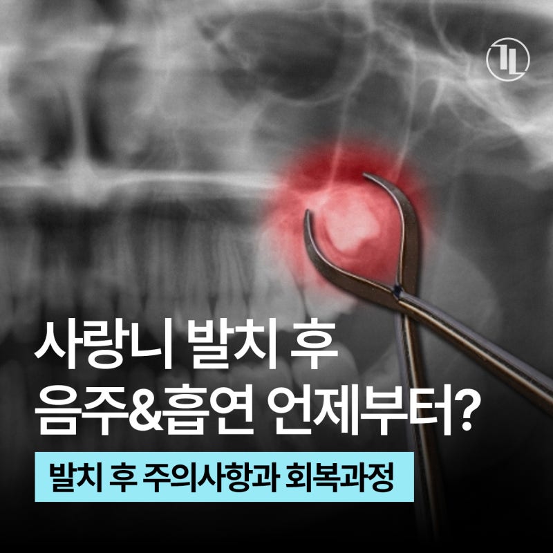 사랑니 발치 후 술&담배 언제 가능? 사랑니 회복 가이드/ 강남레옹치과