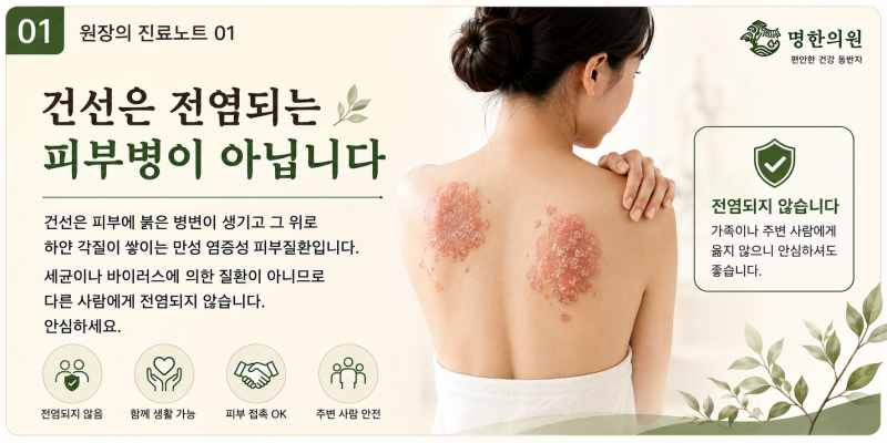 건선의 올바른 이해