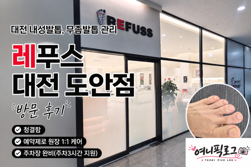대전 도안동 내성발톱 레푸스 대전도안점｜무좀발톱 관리 솔직 후기