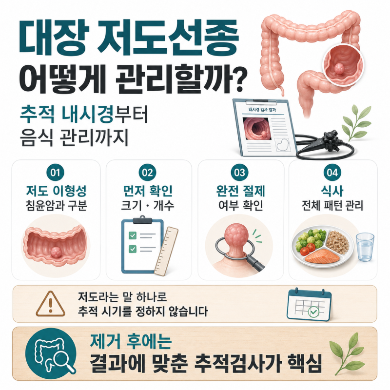 대장 저도선종이란? 추적 내시경과 음식 관리법 정리