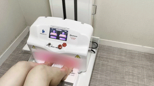 청주무좀피부과, 무좀의 원인부터 발톱무좀 레이저 치료까지