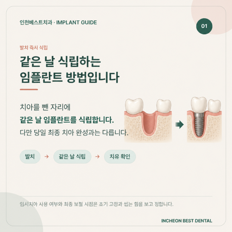 옥련동 임플란트, 발치 후 바로 식립할 수 있을까요?
