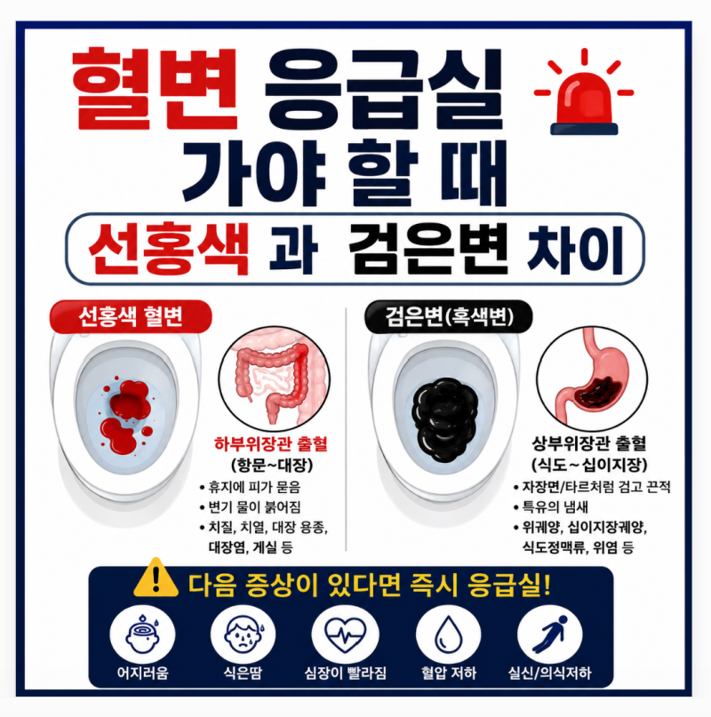 혈변 응급실 가야 할 때 선홍색과 검은변 차이