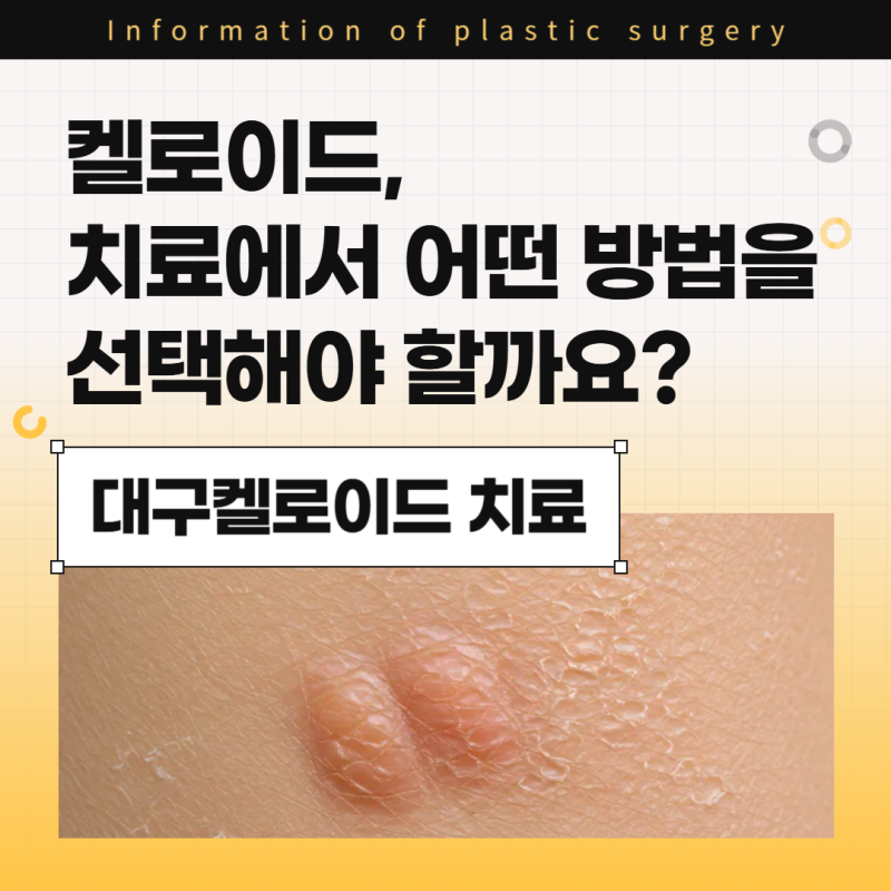 대구켈로이드 , 어떤 치료 방법을 선택해야 할까요?