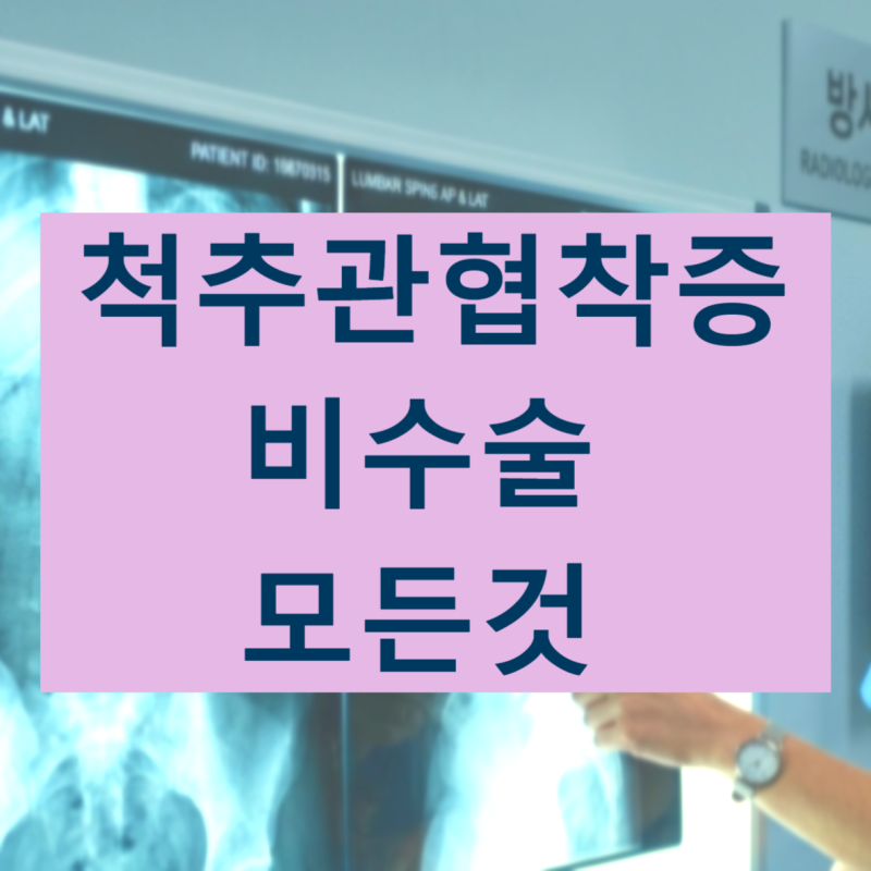 척추 협착증 비수술 치료의 모든 것에 대해 알려 드리겠습니다