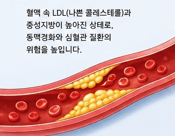 고지혈증 환자가 절대 피해야 할 음식과 반드시 실천해야 할 식습관