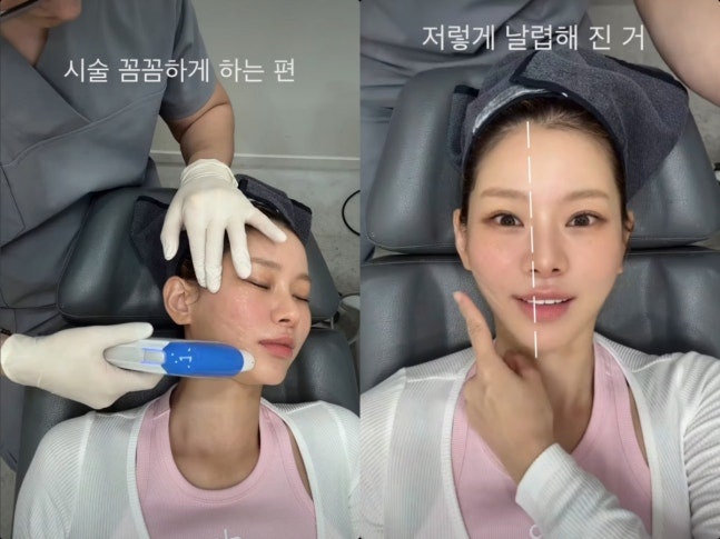 맹승지, 의사 남자친구와 공개 연애 근황…직접 얼굴 관리받은 특별한 일상