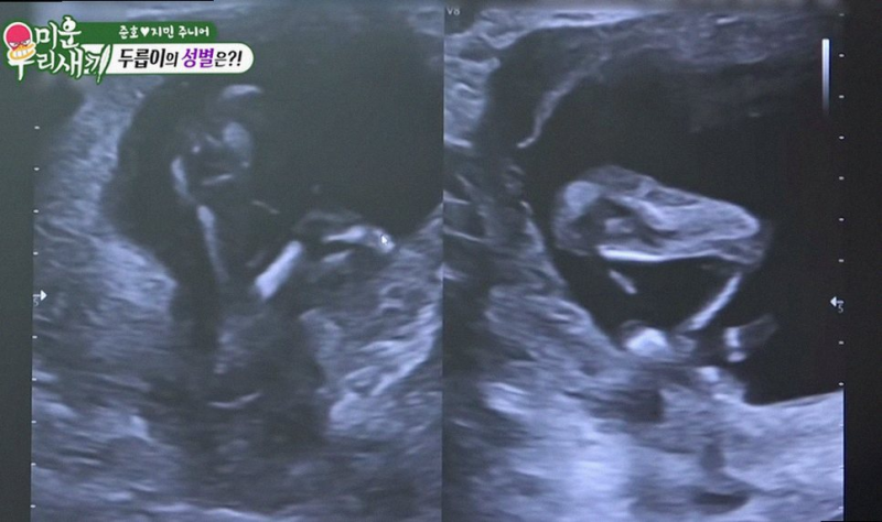 김준호 김지민 임신 성공 52세 아빠의 눈물과 대리 입덧 반전 소식 ✨