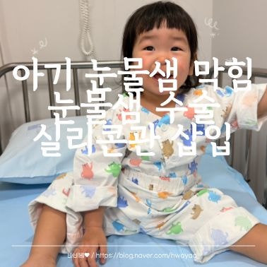 아기 눈물샘 막힘 수술 실리콘관 삽입 ㅣ19개월 전신마취 후기