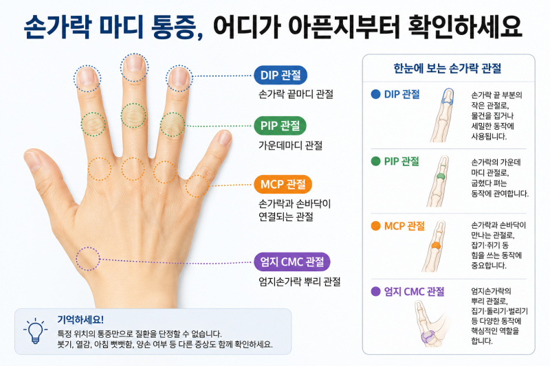 손가락 마디 통증 아침에 뻣뻣하고 붓는다면? 원인과 병원 가야 할 신호