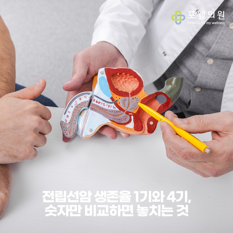 전립선암 생존율 1기와 4기, 숫자만 비교하면 놓치는 것
