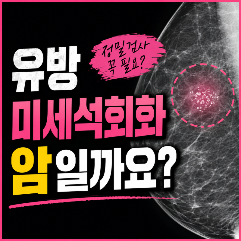 유방촬영 미세석회화, 암일까? BI-RADS·확대촬영·조직검사 기준