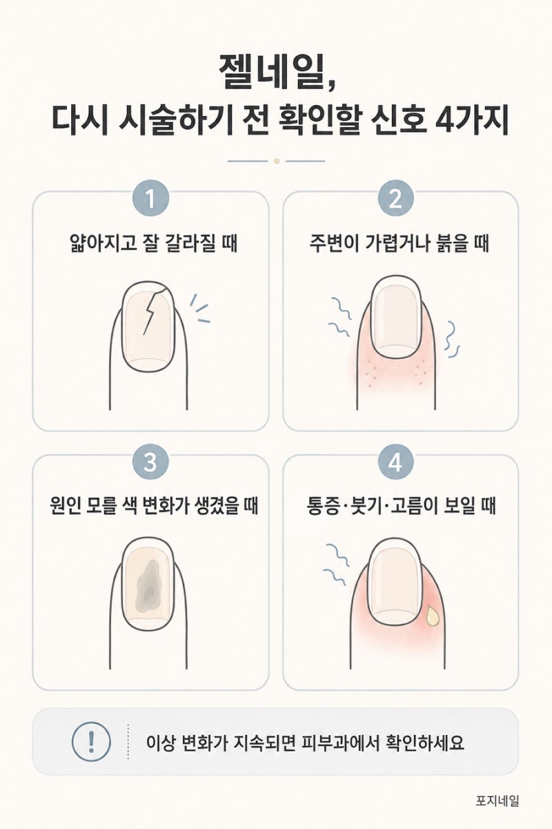 젤네일 쉬어야 할 때? 재시술 전 확인할 손톱 신호 4가지