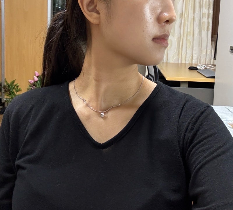 대구 세르프 리프팅 후기 통증과 유지기간 예비신부 피부관리