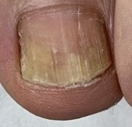 퓨어릴 네일라카 효과 가격