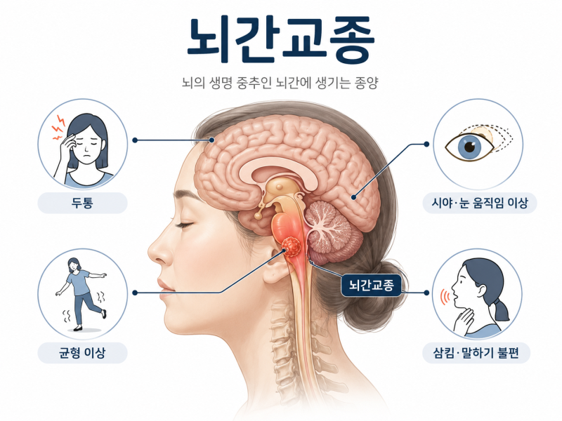 뇌간교종, 완치될 수 있을까? 생존과 치료에서 확인할 것