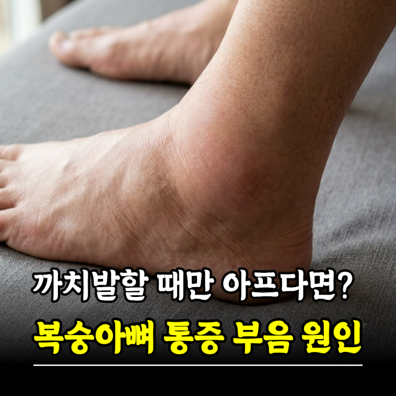 까치발할 때만 아프다면? 복숭아뼈 통증 부음 원인