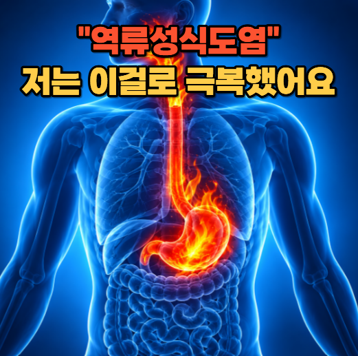 "역류성식도염"으로 극심한 고통을 겪고 있는 분들께 드리는 첨언