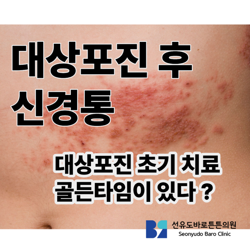 대상포진 초기 증상 이후 신경통 치료까지 [당산/선유도 정형외과]