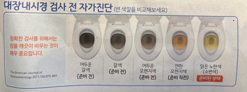대장내시경당일물 마셔도 될까? 검사 전날부터 헷갈렸던 후기