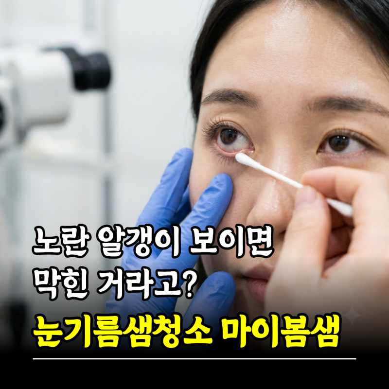 노란 알갱이 보이면 막힌 거라고? 눈기름샘청소 방법 마이봄샘 기능장애
