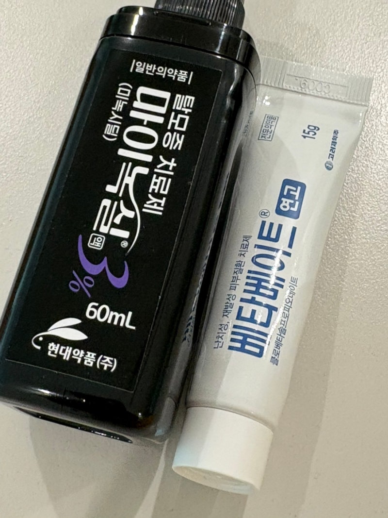 소아탈모 청소년원형탈모 1년간의 치료과정과 경과, 마이녹실 바르는법