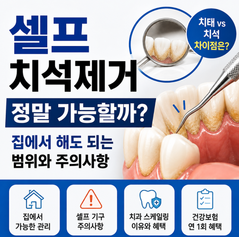 셀프치석제거 정말 가능할까? 집에서 해도 되는 범위와 주의사항