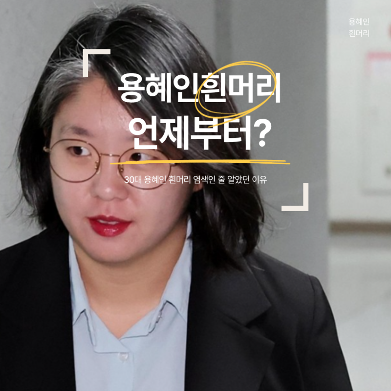 30대 용혜인 흰머리 언제부터? 염색인 줄 알았던 이유