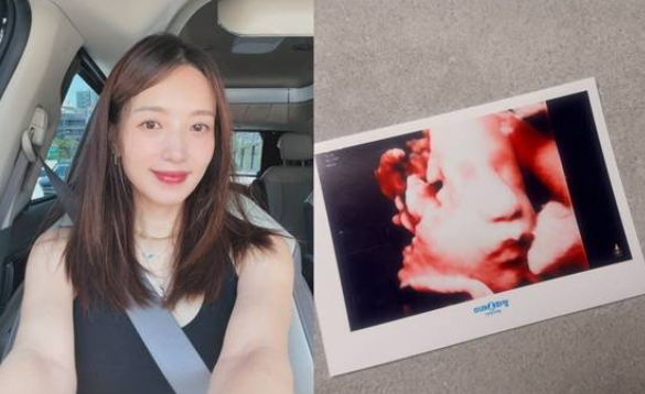 미스코리아 김민경 45세에 엄마 됐다 손목 팔찌에 적힌 2.72kg 첫아들