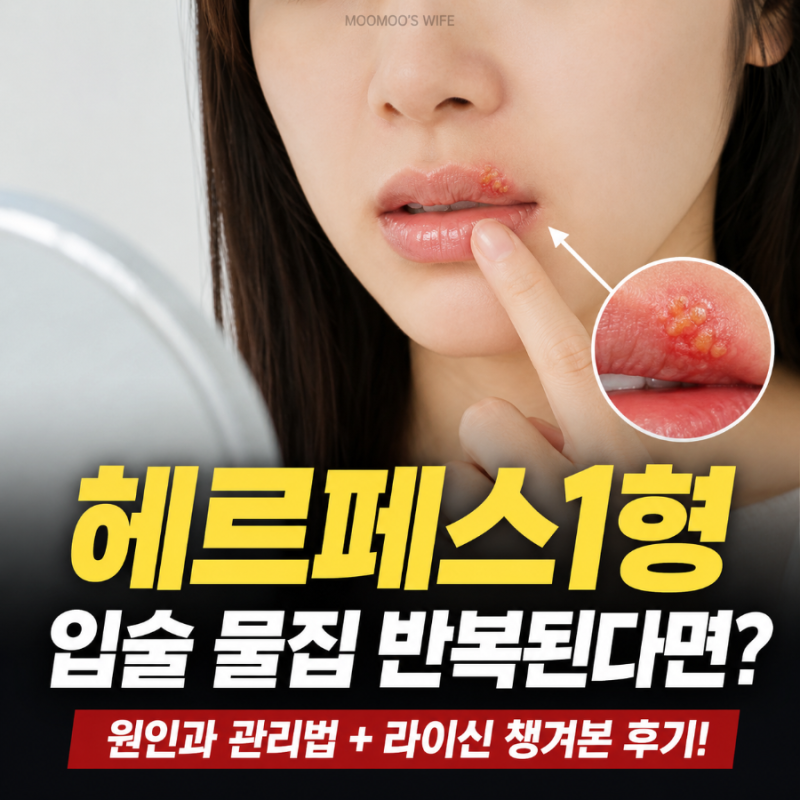 헤르페스1형 입술 물집 원인 증상 라이신 관리 후기