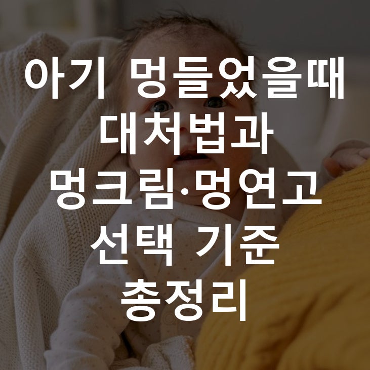 아기 멍들었을때 대처법과 멍크림·멍연고 선택 기준 총정리