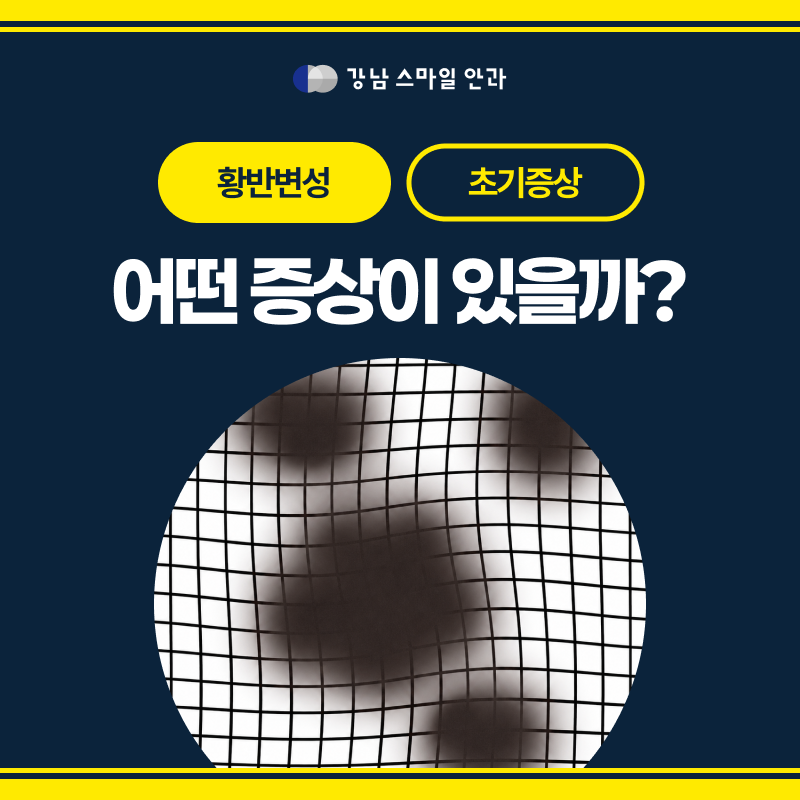 교대역안과 황반변성 초기증상, 어떤 증상이 나타날까요? (+ 치료 병원 암슬러격자검사)