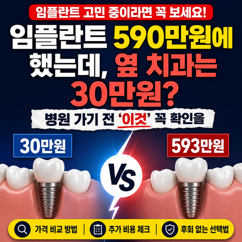 임플란트 30만원 vs 593만원…가격만 보고 치과 가면 놓치는 것